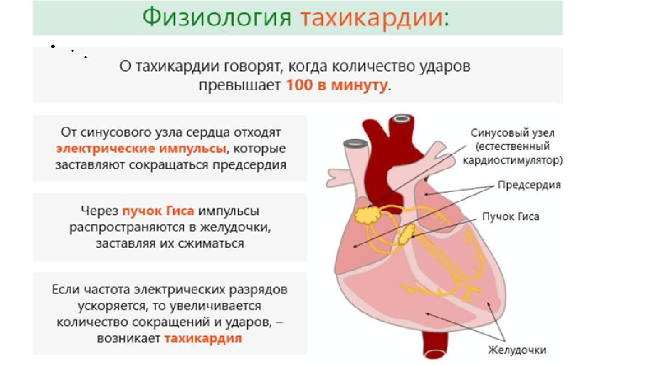 Может ли остановиться сердце. Сердечная тахикардия симптомы. Тахикардия физиология. Физиологическая тахикардия. Учащенное сердцебиение тахикардия.